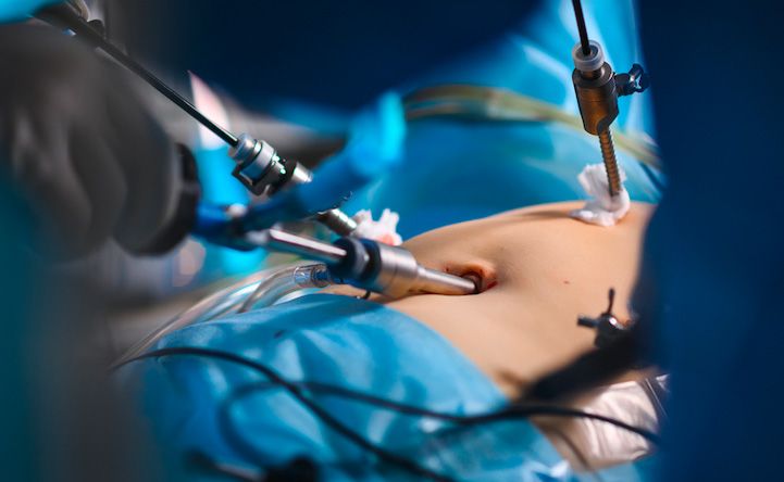 minimally invasive surgery