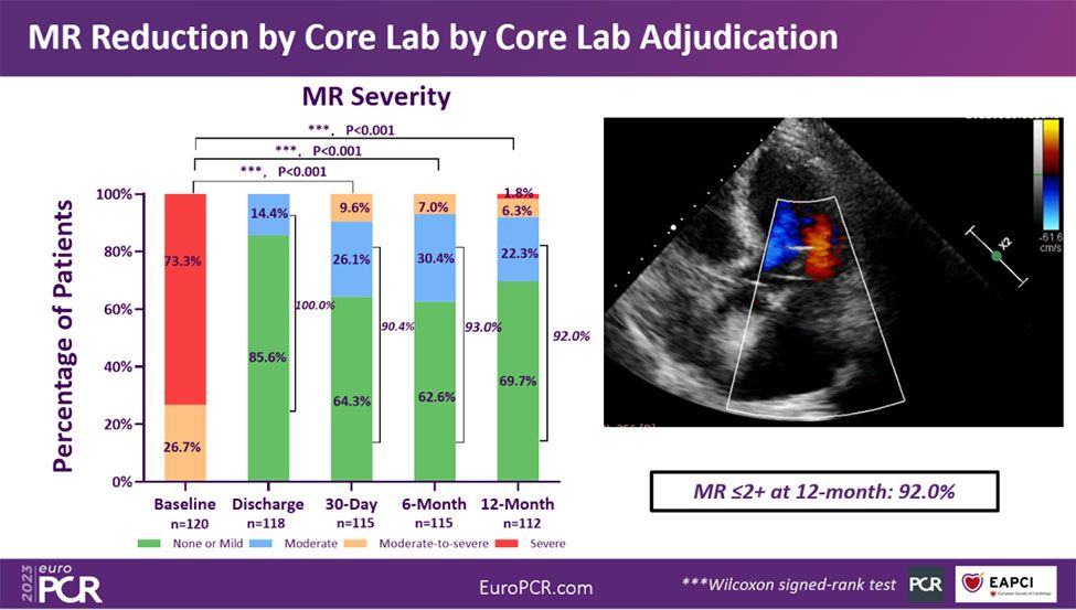 MR Reduction by Core Lab by Core Lab Adjudication