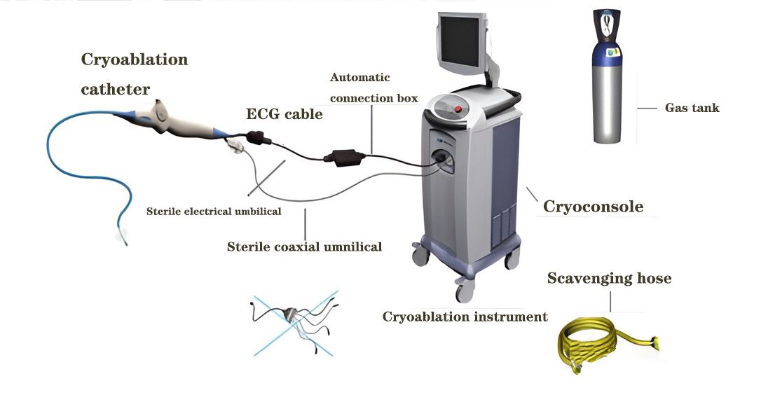 Basic Components of a Cryoablation System