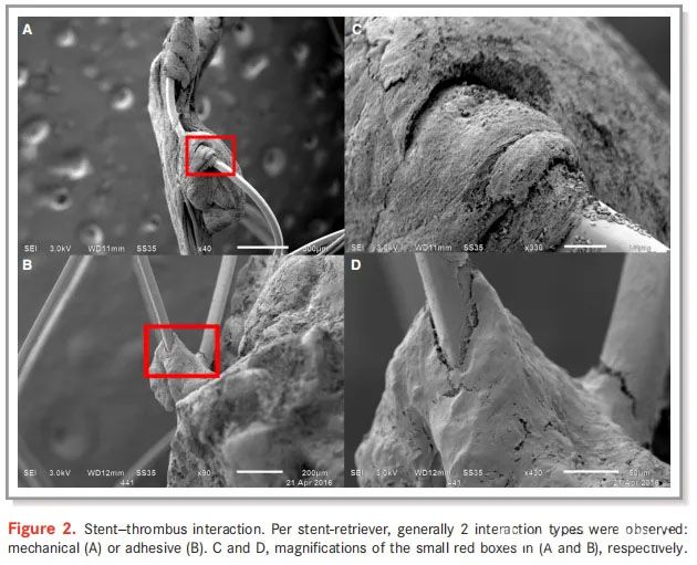 Stent-thrombus interaction