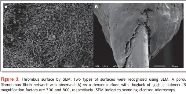 Thrombus surface by SEM