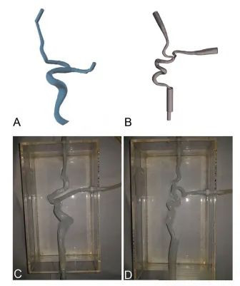 vascular models