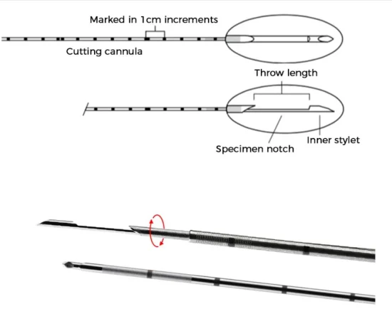 the components of a typical biopsy needle, including the outer hollow needle and inner needle with a cutting notch