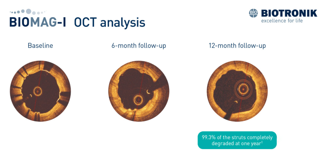 OCT analysis