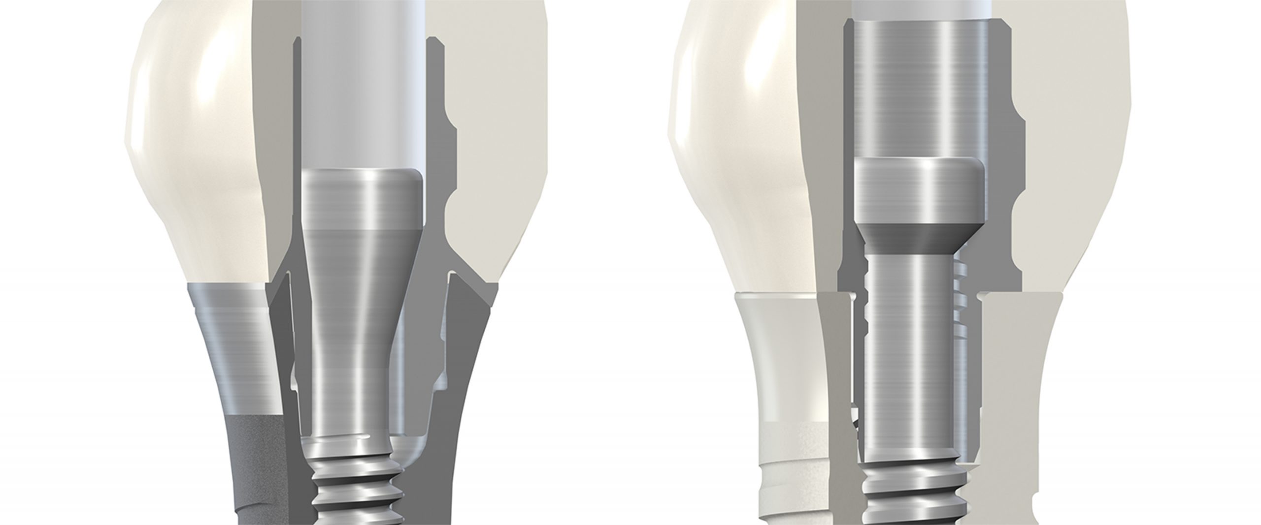 A close-up of titanium and zirconia straight abutments, showcasing their precise design and smooth surface finish