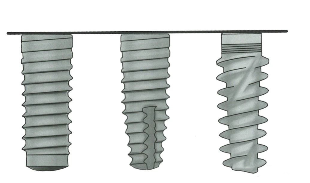 Implant Shape  ▲ From left to right: Cylindrical, Root-shaped, Biconical shape