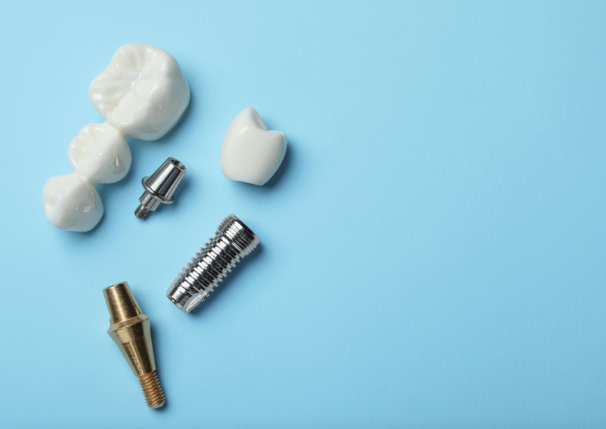 Screw-Retained Abutment Protective Caps