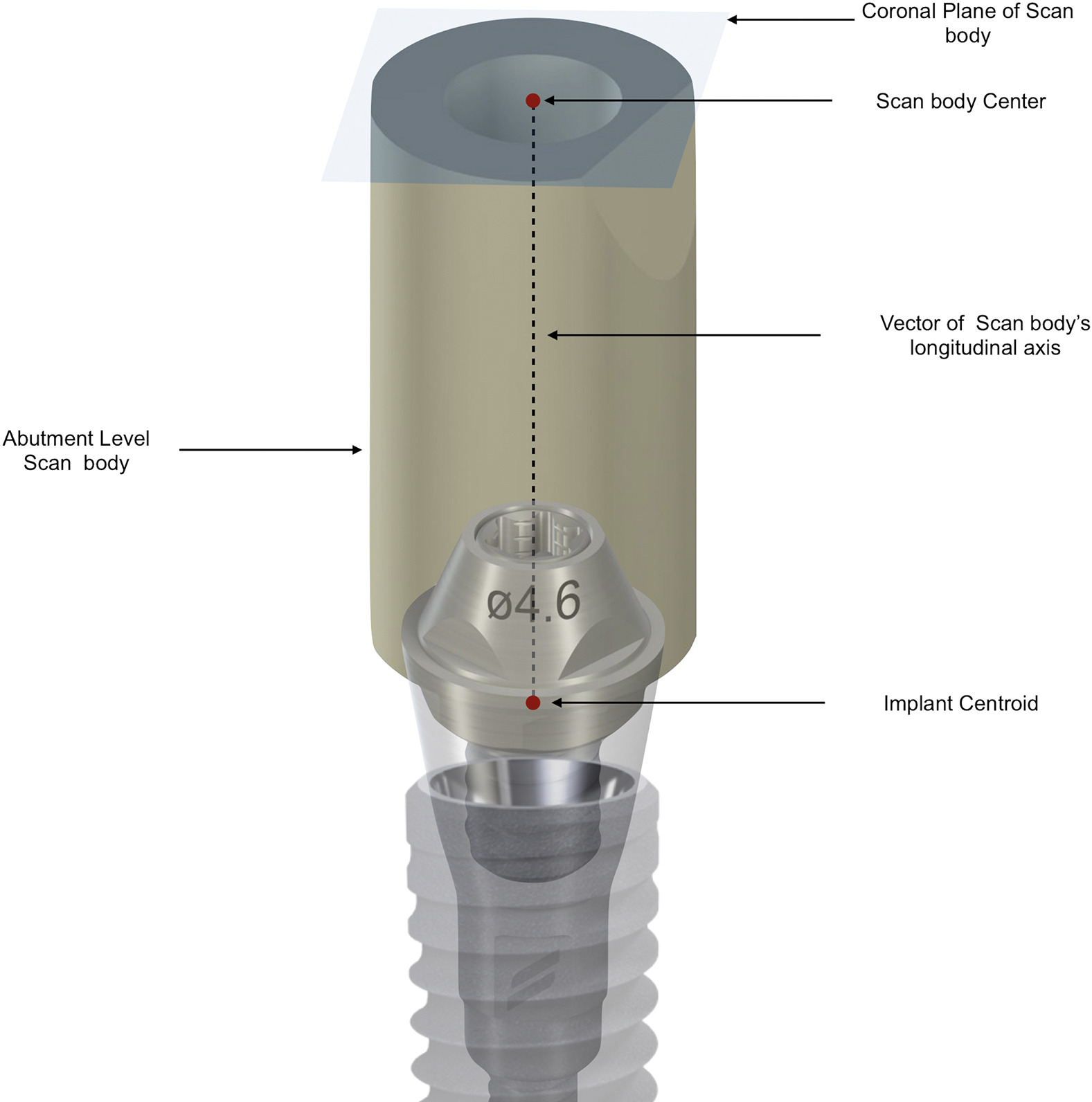  Abutment-Level Scan Bodies