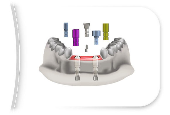  Implant-level Analogues